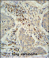 KXD1 Antibody (Center)